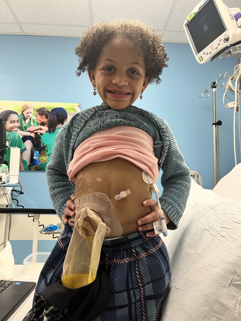 Little girl in hospital smiling with ostomy bag