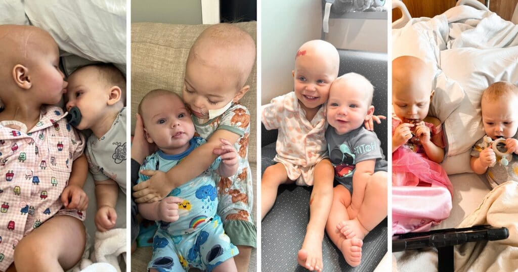 Four heartwarming images of a brother an sister with bald heads, smiling and cuddling together in various settings, conveying warmth and joy.
