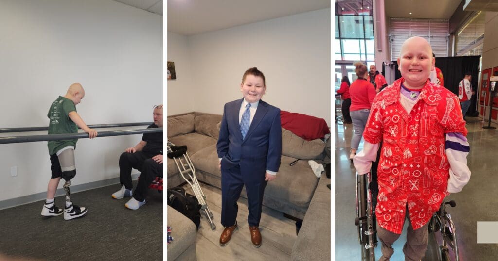 A boy with a prosthetic leg practices walking using parallel bars, smiles in a blue suit indoors, and is joyful in a red outfit at an event.