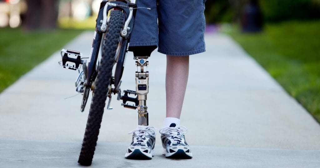 A person wearing sneakers and shorts stands on a sidewalk, holding a bike. A prosthetic leg is visible, conveying determination and resilience.
